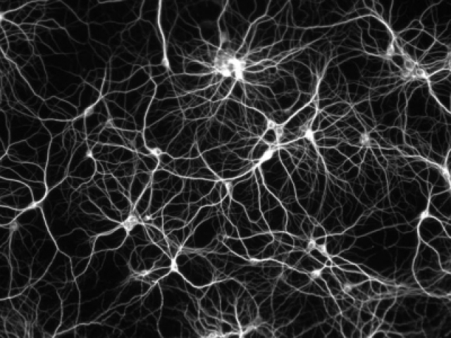 neuron-network_7.jpg?itok=D1MrEBYO